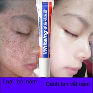 kem tàn nhang làm trắng 20g loại bỏ đốm Loại bỏ các đốm đen sâu Làm trắng da mặt nhanh chóng tàn nhang da chống lão hóa
