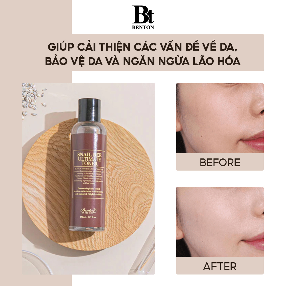 Nước Hoa Hồng Dưỡng Ẩm, Ngăn Lão Hóa Benton Snail Bee Ultimate Toner 150ml