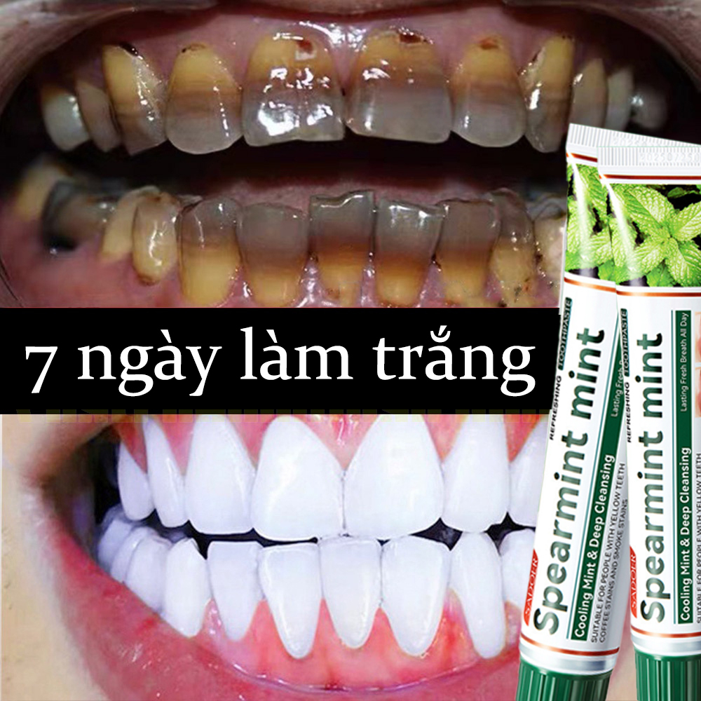 Kem Đánh Răng Ngừa Sâu Răng Giúp Hơi Thở Thơm Mát Bạc Hà Vệ Sinh Răng Miệng Không Hôi Miệng giúp răng trắng sáng 100g