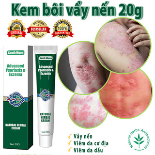 Kem bôi vảy nến, nấm ngứa, á sừng - Kem chống ngứa thảo dược，Kem bôi hắc lào nấm mông bẹn vẩy nến nước ăn chân