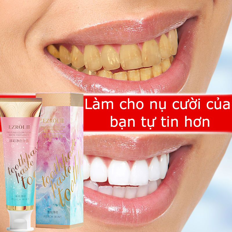 kem đánh răng làm trắng 100g làm trắng nhanh loại bỏ hiệu quả vết bẩn răng hơi thở hôi bảo vệ nướu răng làm mới hơi thở
