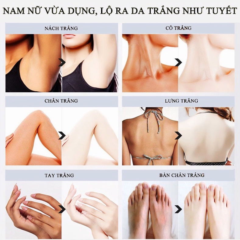 Sữa tắm trắng da Tẩy tế bào chết làm trắng nhanh Sữa tắm Dê Care 800ml