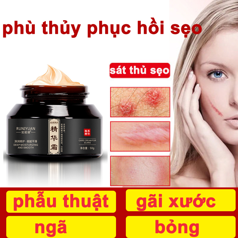 kem xóa sẹo kem xóa sẹo vết rạn da loại bỏ vết sẹo vết sẹo cũ mổ lấy thai đốt cháy bỏng nước sẹo mụn những vết xước