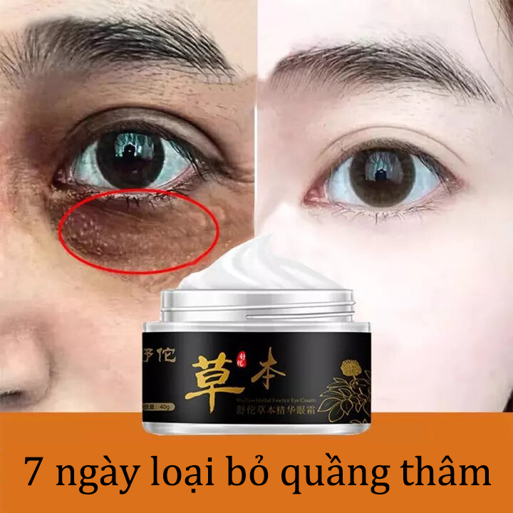 Kem Mắt KEM THÂM QUẦNG MẮT Kem dưỡng mắt 40g giảm nếp nhăn giảm quầng thâm làm sáng ẩm cho da xóa tan bọng mắt