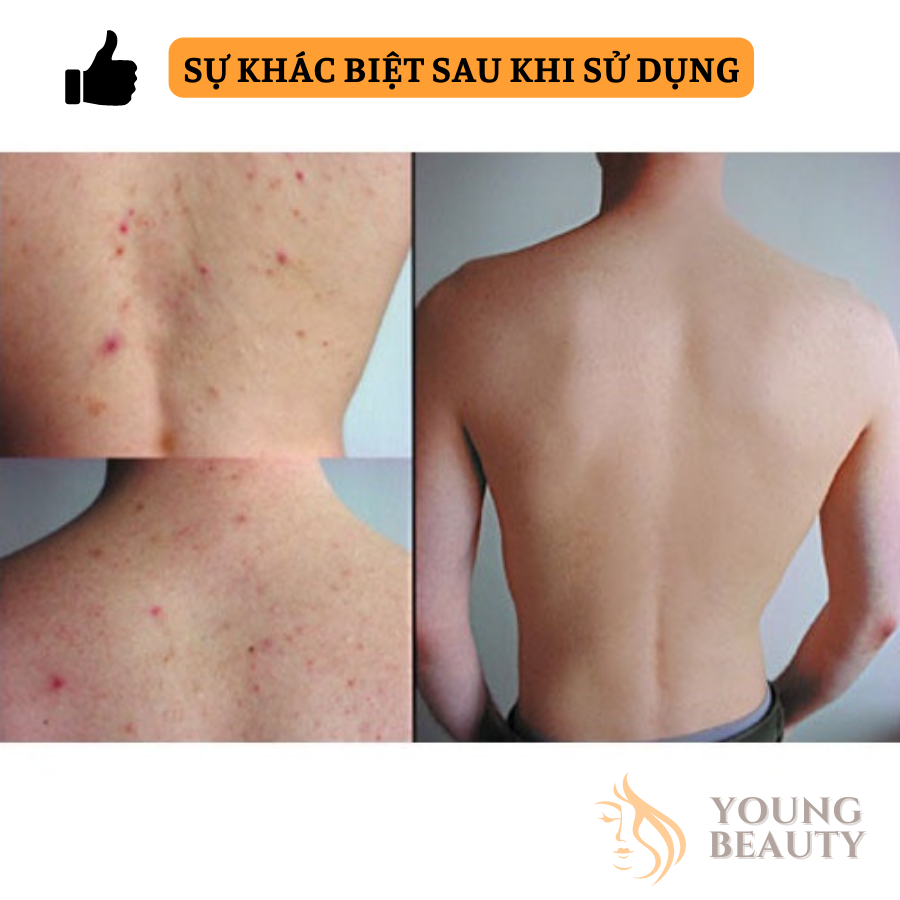 Xà phòng tắm DAISHIHAN - Xà bông cục hữu cơ giảm mụn thâm, đen sạm, dưỡng trắng da, mùi thơm dễ chịu - YOUNG BEAUTY