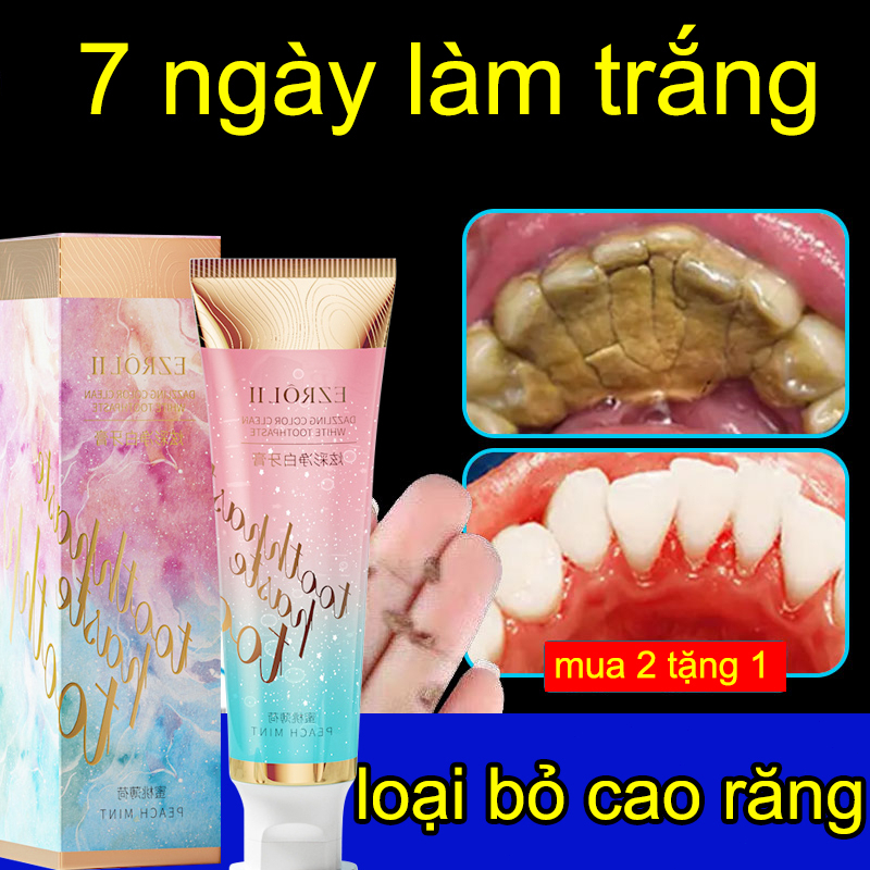 Kem đánh răng làm trắng Kem Đánh Răng Kem tẩy trắng răng 100g Đánh Bay Mọi Vết Ố Vàng Trên Răng hơi thở thơm mát