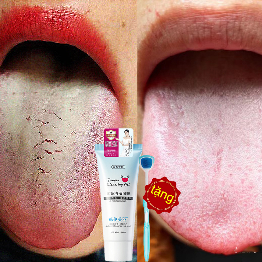 Gel Làm Sạch Lưỡi Đồ vệ sinh lưỡi 45g cạo lưỡi chăm sóc lưỡi sạch toàn diện diệt khuẩn khử hôi miệng vệ sinh lưỡi