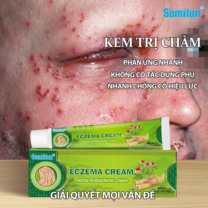 【Hiệu quả 100%】Kem trị chàm Viêm da cơ địa Kem bôi viêm da cơ địa Thuốc trị chàm Bệnh vẩy nến Chăm sóc da