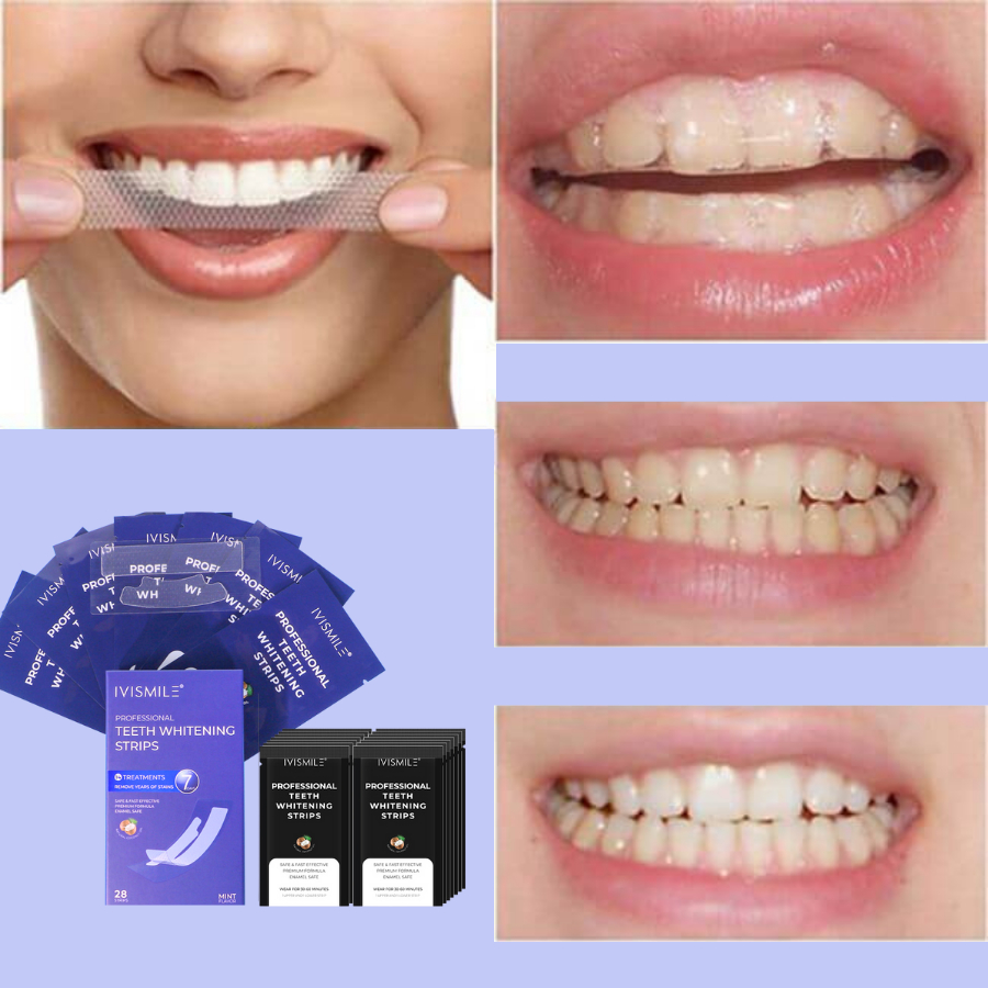 Miếng dán trắng răng IVI SMILE, Miếng dán răng an toàn không gây cảm giác ê buốt | BigBuy360 - bigbuy360.vn
