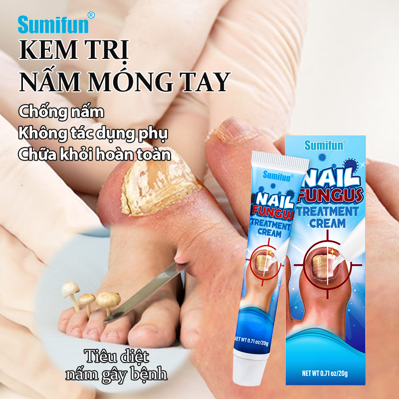 SUMIFUN Thuốc trị nấm móng Kem Điều trị nấm loại bỏ móng Chăm sóc móng kem Điều trị nấm móng tay hiệu quả