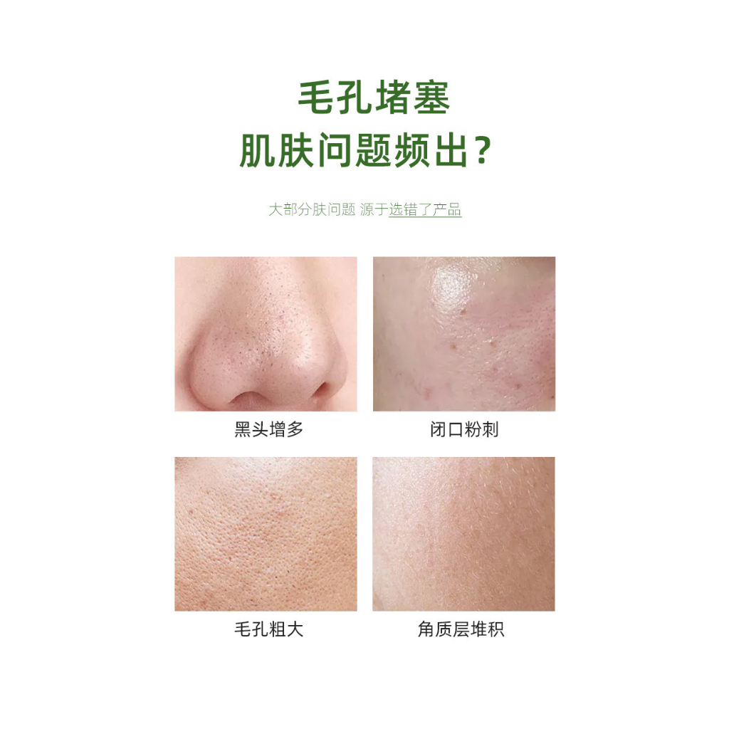 Hộp 12 Mặt Nạ Bơ Sủi Bọt YINBA 4g x 12 Gói