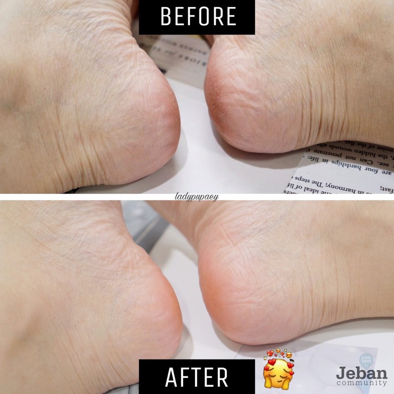 Kem Bôi Giảm Nứt Gót Chân Heel Spa Thái Lan Tuýp 20g