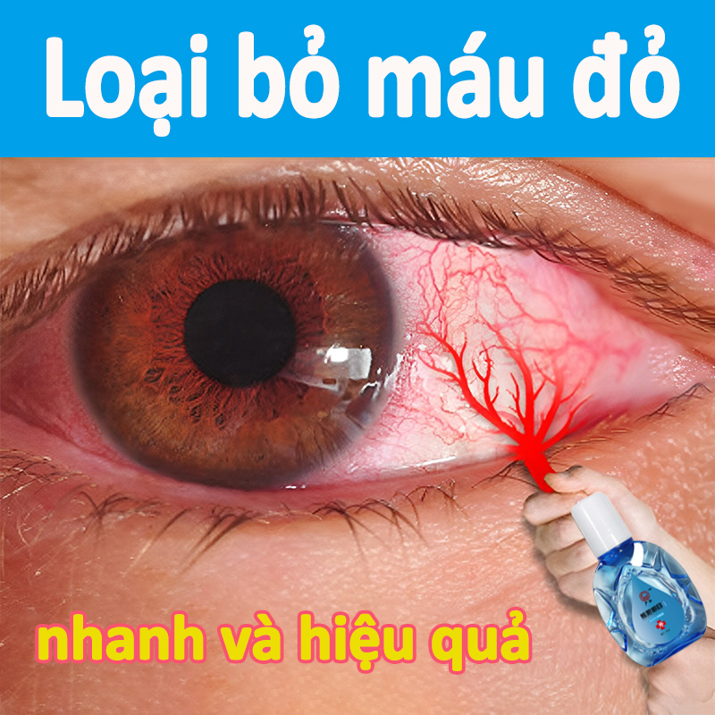 Nước nhỏ mắt không chất bảo quản 15ml Nước mắt nhân tạo giúp mắt bớt khô mỏi giảm mỏi mắt hội chứng khô mắt