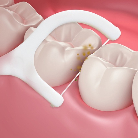 Tăm Chỉ Nha Khoa Hộp 50 Chiếc