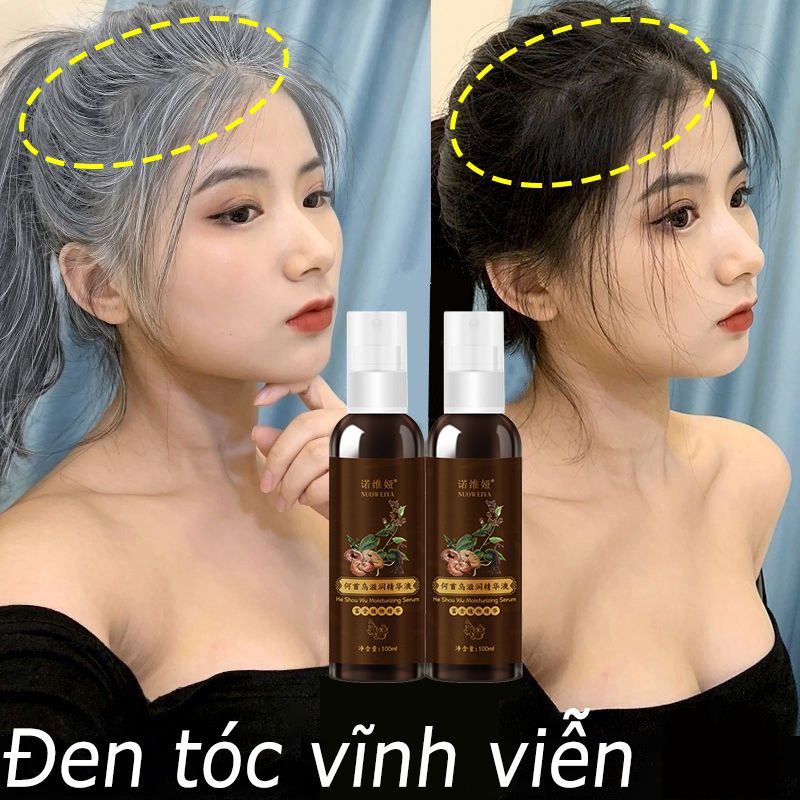 Tinh chất đen tóc Xịt mọc tóc 100ml Chiết xuất thực vật tự nhiên có hiệu quả tóc đen Tóc mọc Chống rụng tóc dưỡng tóc