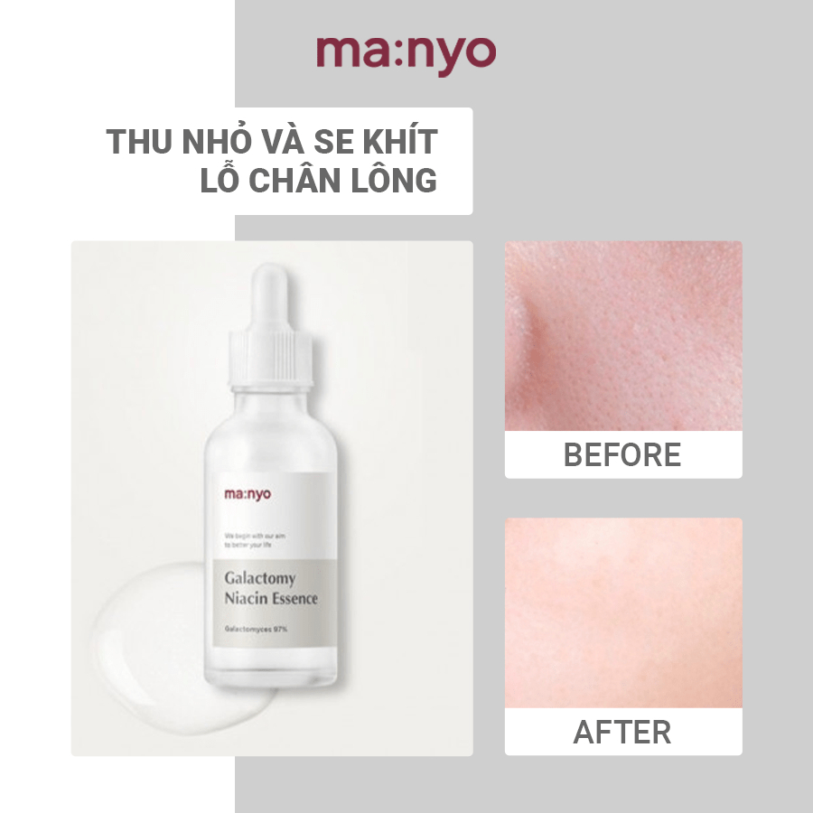Tinh Chất Dưỡng Trắng Manyo Galactomy Niacin Essence 50ml/8ML MA:NYO