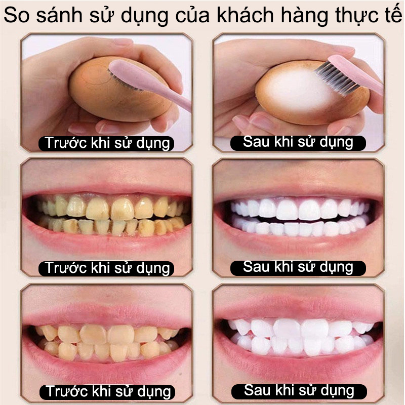 Kem đánh răng trắng răng Viên đánh trắng răng Hũ 30 viên sạch mảng bám ngừa sâu răng Cấp tốc Tẩy cao răng