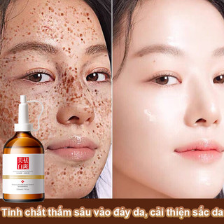 Kem bôi trắng da mặt kem tẩy trắng da cấp tốc xóa vết thâm nám vết chân chim làm mờ hắc tố làm trắng da