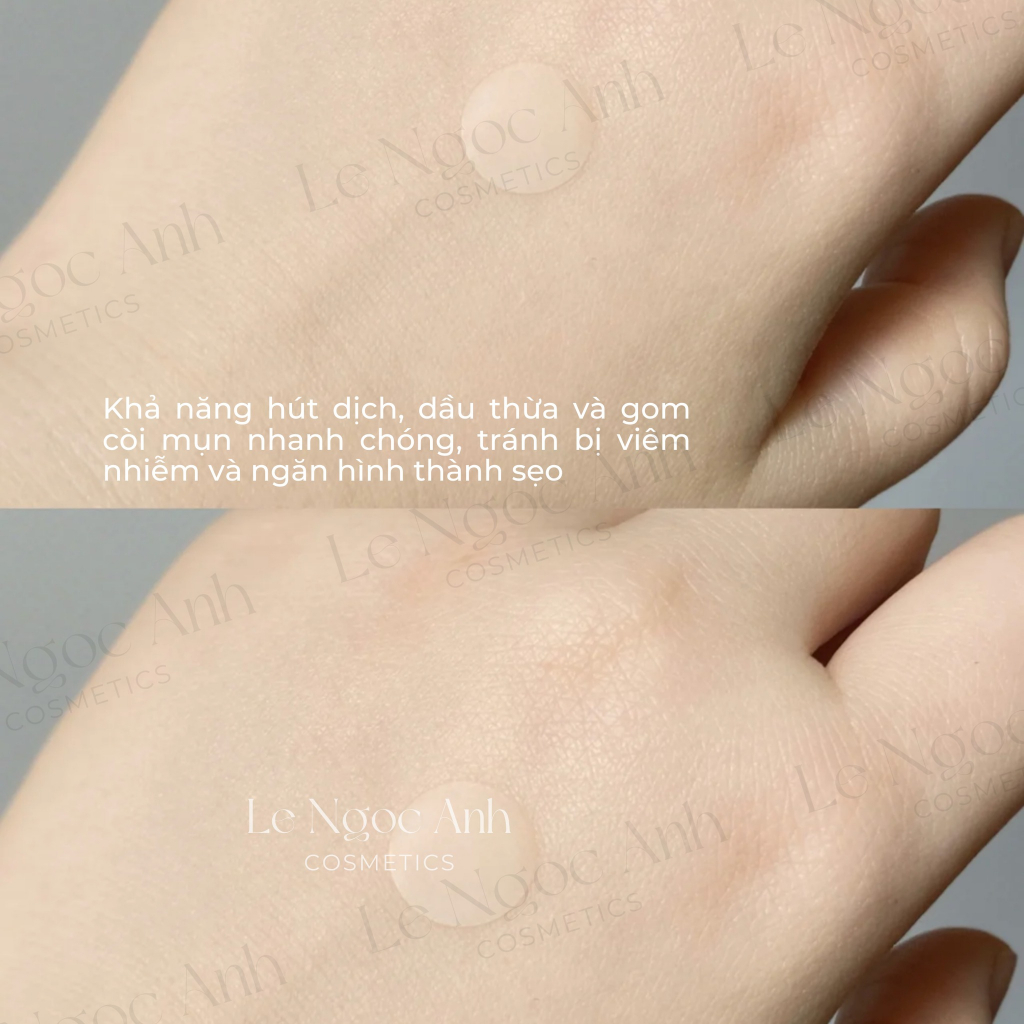 Miếng Dán Mụn Cosrx Master Patch 18- 24 Miếng