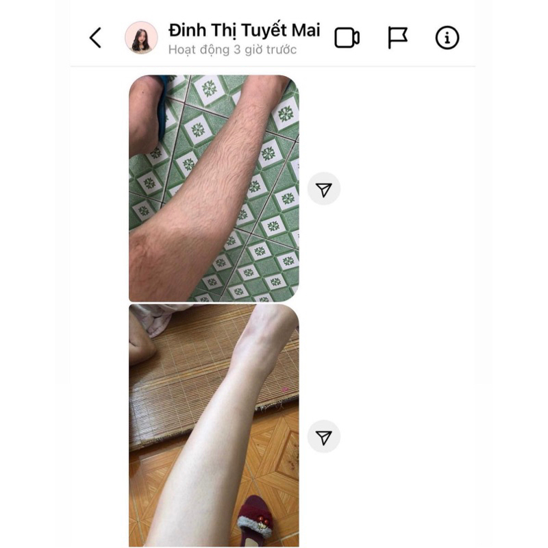 Kem tẩy lông Vari.- Triệt Lông Vari Tại Nhà -Triệt Lông Chân , Tay , Nách,bikini + Kèm Mỡ Trăn