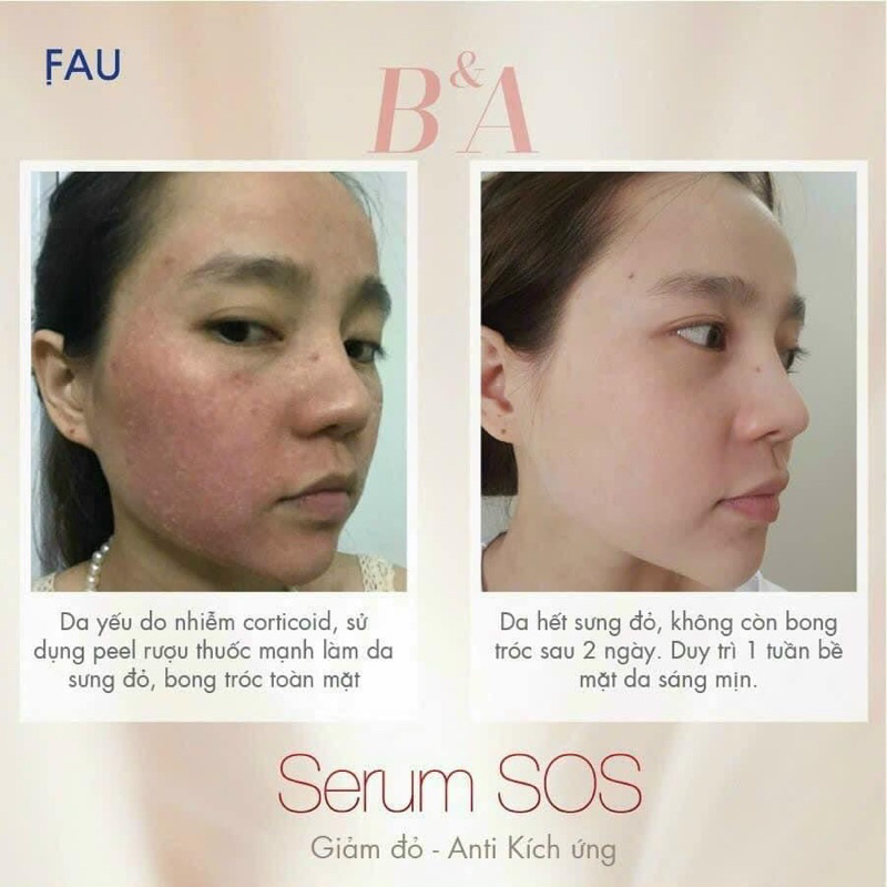 Serum làm dịu, giảm đỏ và phục hồi da FAU SOS Serum 100ml