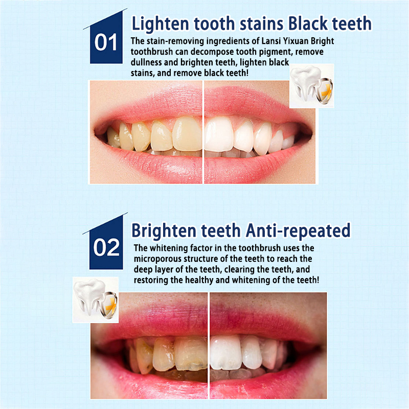 🎶Bút Tẩy Trắng Răng Gấp 4 Lần Dazzling White