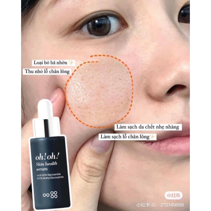 Serum Niacinamide 20% Oh!Oh dưỡng sáng và kiểm soát lcl