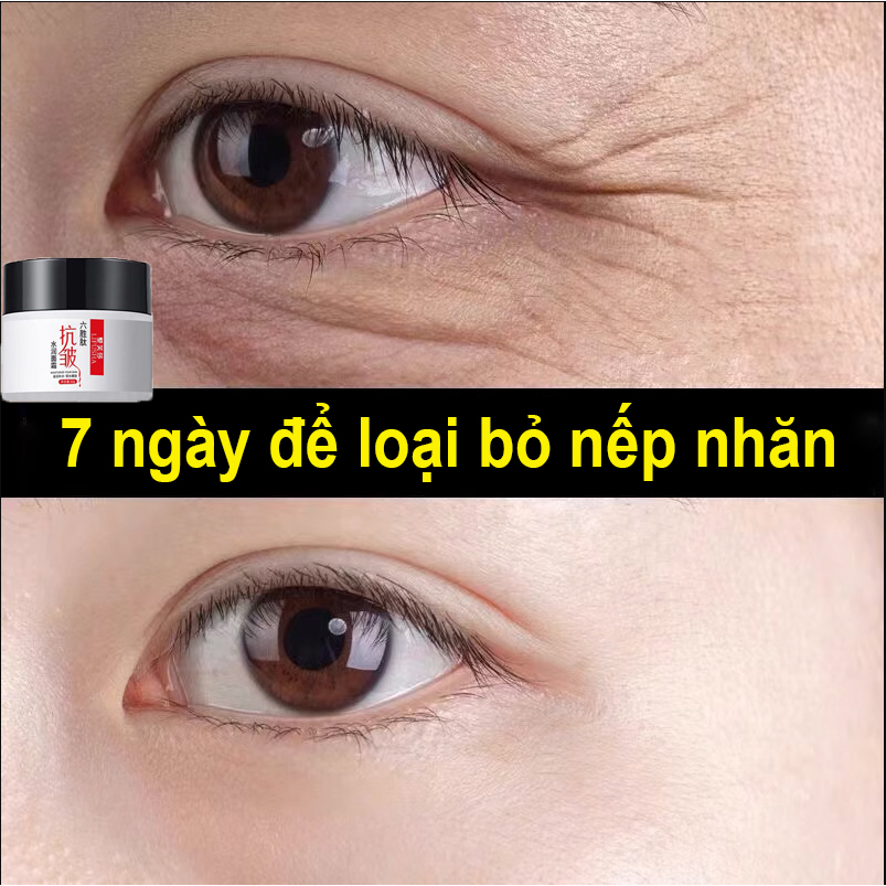 Kem xóa nếp nhăn nhanh 50ml Nhanh chóng làm mịn nếp nhăn，Chống lão hóa Túi mắt Nếp nhăn Chăm sóc da mặt