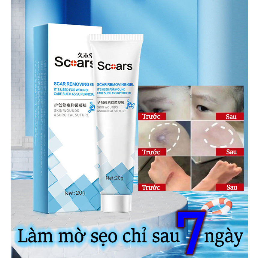 Kem xóa sẹo, loại bỏ hiệu quả các vết sẹo lâu năm, sẹo phẫu thuật, phục hồi và làm sáng các vết rạn da, dưỡng vết bỏng
