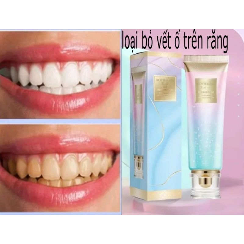 Kem đánh răng trắng Niacinamide Bodyaid.Hơi thở thêm mát 100g