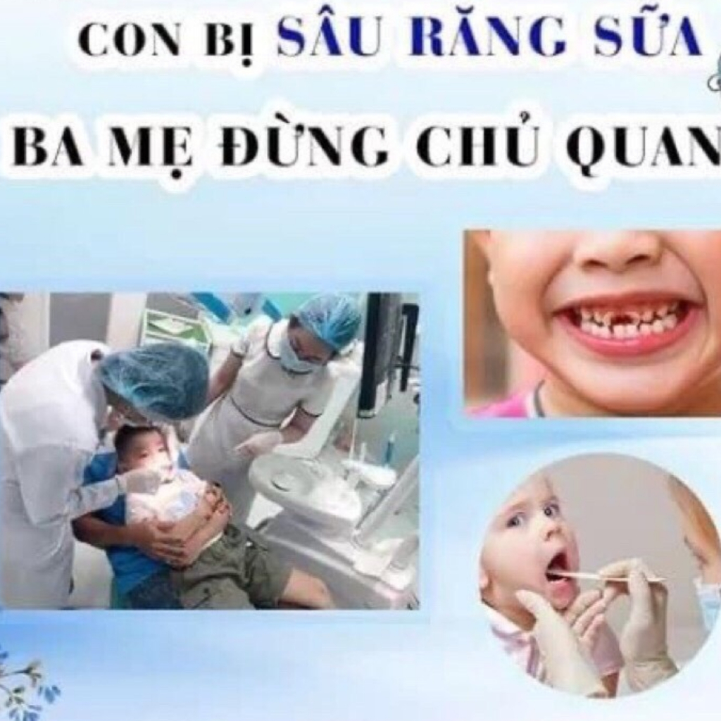 Vecni Fluor - Enamel Pro varnish - Sản phẩm  phòng  ngừa Sâu Răng _ Ê Răng  - Sún Răng