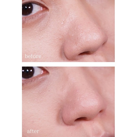 Serum tẩy tế bào chết The Ordinary AHA 30% + BHA 2% Peeling Solution