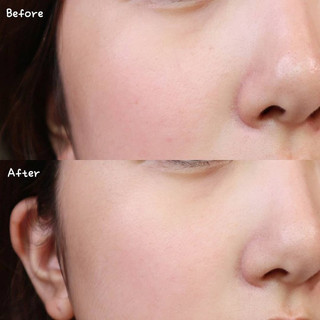 Serum tẩy da chết, mờ thâm The Ordinary Lactic 5% + HA