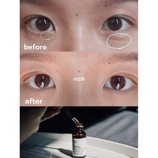 Serum dưỡng da mắt The Ordinary Caffeine solution 5% + EGCG