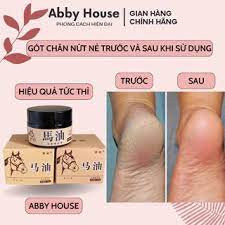 𝐊𝐞𝐦 𝐜𝐚𝐨 𝐧𝐠𝐮̛̣𝐚 dầu ngựa chính hãng