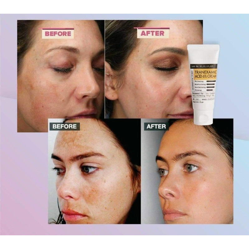 KEM DƯỠNG DA DERMA FACTORY BAKUCHIOL 1% VÀ TRANEXAMIC ACID 6%