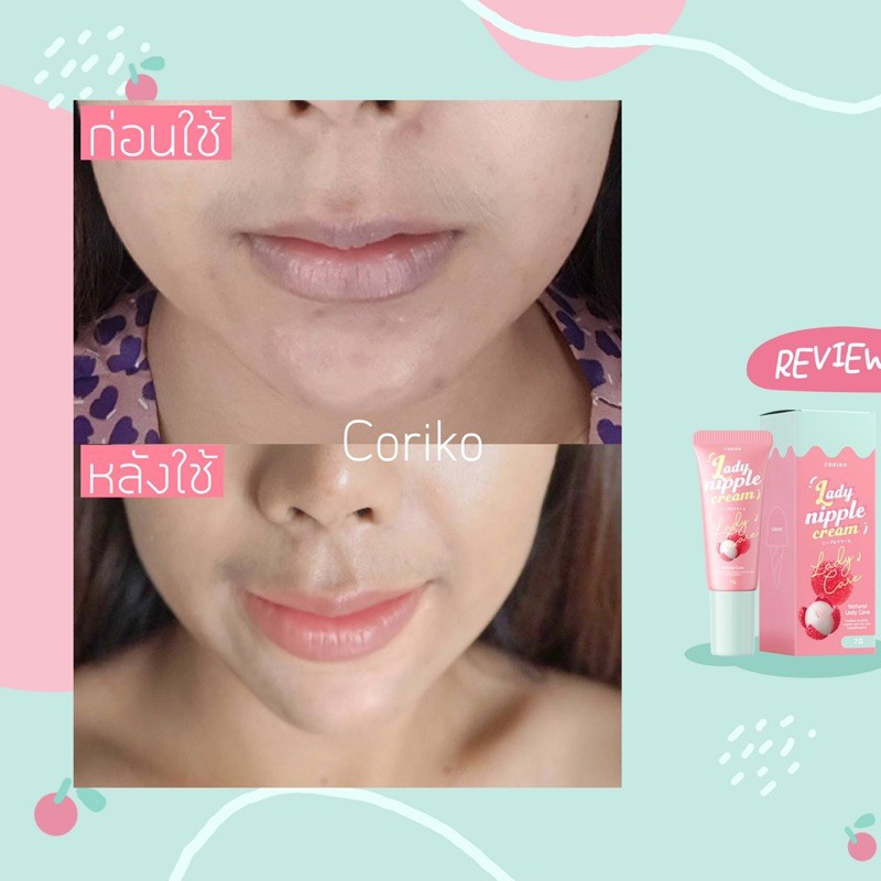 Kem Thâm Vú và Môi Lady Nipple Cream Thái Lan