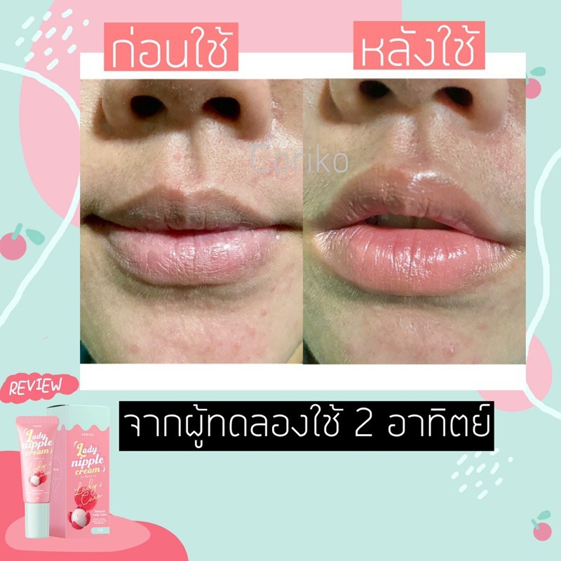 Kem Thâm Vú và Môi Lady Nipple Cream Thái Lan