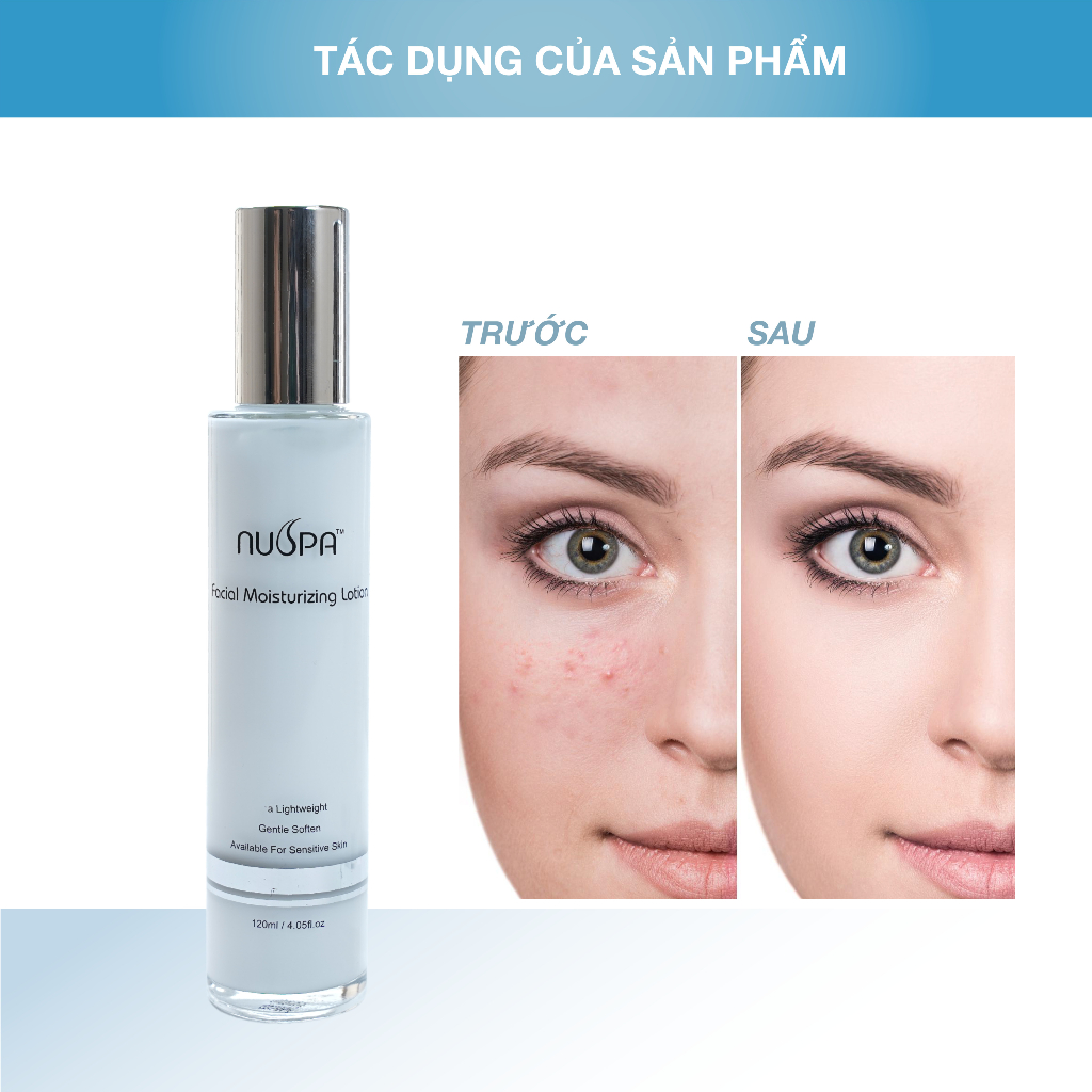 Sữa dưỡng ẩm  da mặt  giàu collagen, Vitamin B5,cấp ẩm, làm sáng da Facial Moisturizing Lotion NUSPA 120ml |NuspaVietNam | BigBuy360 - bigbuy360.vn