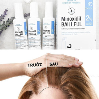Xịt mọc tóc Minoxidil Bailleul 2% - Hàng Pháp