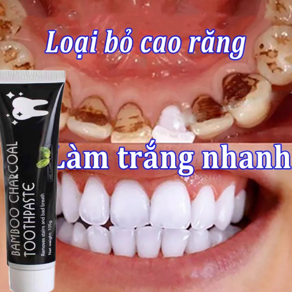 Kem Đánh Răng BAMBOO CHARCOAL TOOTHPASTE Giúp Trắng Răng, Loại Bỏ Mùi Hôi, Chống Sưng Nướu Dental，Làm sạch kem đánh răn