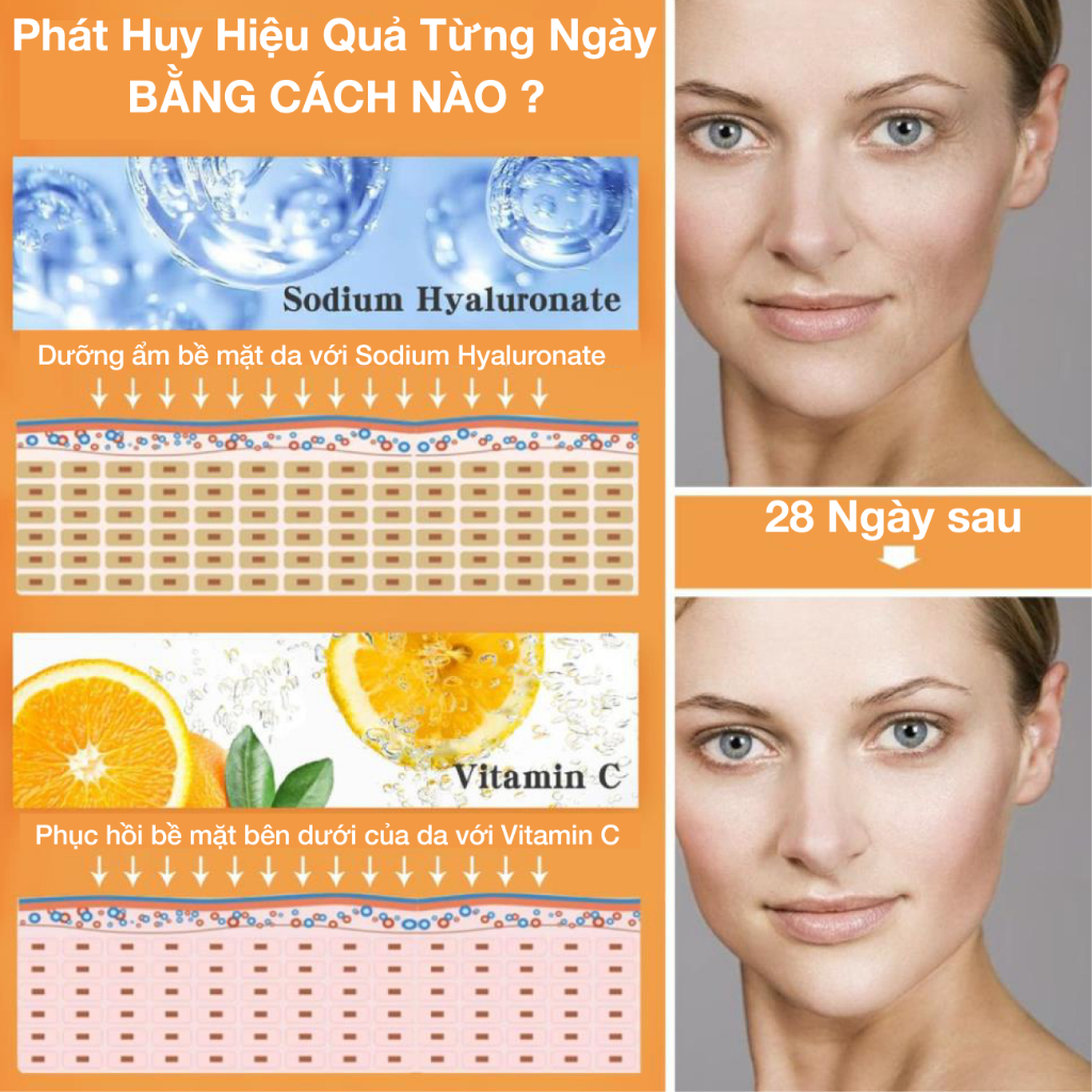 Tinh chất dưỡng da NUSPA Vitamin C Serum 31% hữu cơ giúp giảm thâm sáng da 30ml/60ml