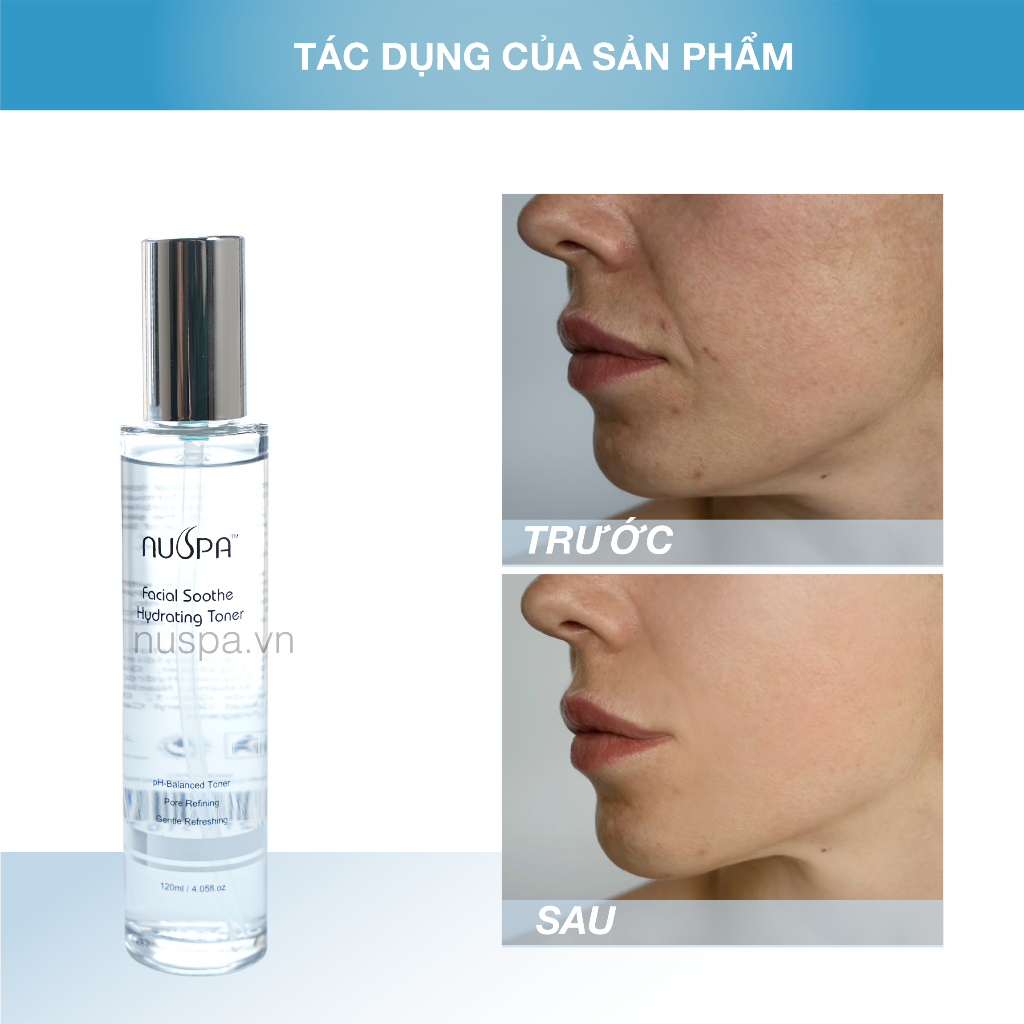 Nước hoa hồng cấp nước, dưỡng ẩm và làm dịu da , Facial Soothe Hydrating Toner NUSPA 120ml | NuspaVietNam | BigBuy360 - bigbuy360.vn