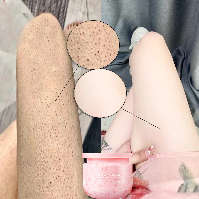Kem tẩy da chết Tẩy tế bào chết body Kem dưỡng trắng Giảm bớt da gà Làm sáng da màu dưỡng ẩm
