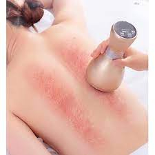 Máy Giác Hơi | Máy giác hơi cạo gió tích điện 9 cấp độ đả thông kinh lạc