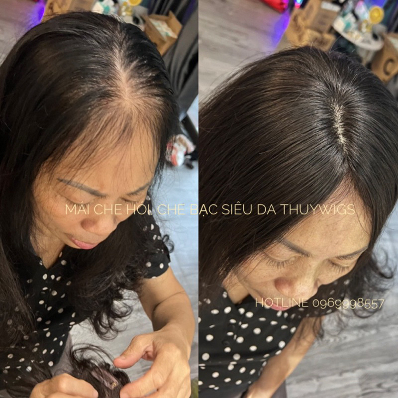 [Tóc Mái Che Bạc Che Hói] Siêu Da Đầu Tóc Thật 💯%