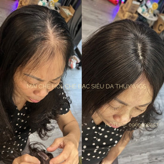 Siêu da đầu tóc thật 💯%
