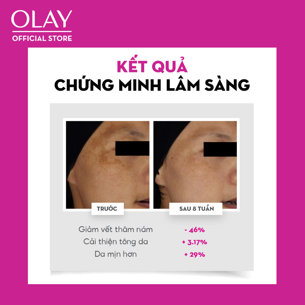 Combo 2: Kem Dưỡng + Serum Sáng Da, Mờ Thâm Mụn OLAY LUMINOUS NIACINAMIDE AHA (50G + 30ML)