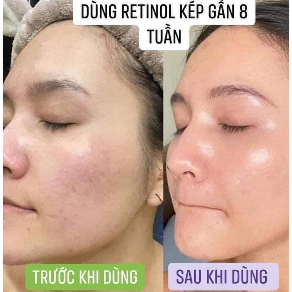 Kem DeAge Retinol Pro