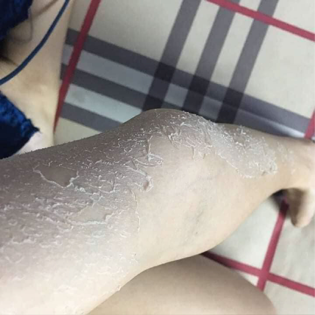 Body bong da - Body peel da - Body bong tái tạo da Handmade 200gr - Đánh bay mọi làn da đen sạm